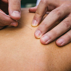 Triggerpoint Therapie & Dry Needling behandeling bij Casa-Sana Sporttherapie & Massage in Maastricht.