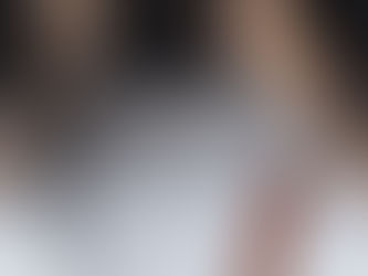 Does PRP cause hair Shedding??