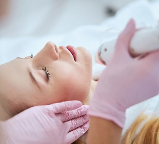 blonde-woman-receiving-the-fractional-microneedling-treatment.jpg