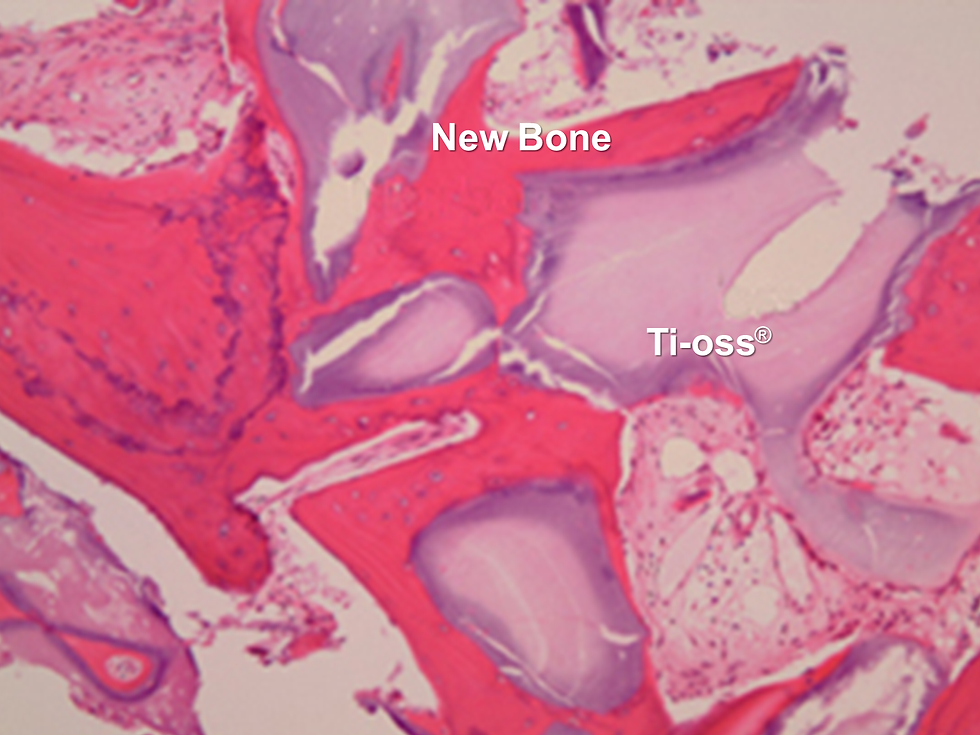 4 Months Biopsy