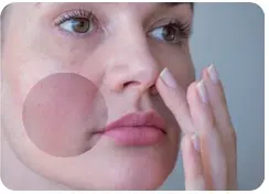 Miniatura: Woman applying cream to her face, Olio di PERILLA PURO 100% Anti-Age, for skincare routine.