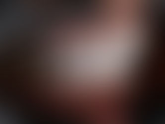 Resultado final de carillas dentales