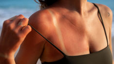 曬傷曬黑怎麼辦？曬後的護理及急救流程！Yanis Beauty・\荷蘭膠原美白艙/ 急救修復肌膚，還原淨白肌！