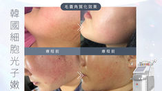 一機對抗皮膚各種頑固問題！ Yanis Beauty・＼最新Cell Light Platinum®️ 韓國細胞光子嫩膚／，極致完美升級，重塑完美無瑕肌膚狀態。