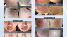 《皮膚的光語時代：Cell Light Platinum 細胞光子嫩膚，讓肌膚重啟對話》