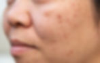 ree