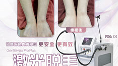 4大脫毛儀器比較！ Yanis Beauty・領先引進＼脫毛界頂級版Candela GentleMax Pro Plus™️／終極脫毛美膚方案。