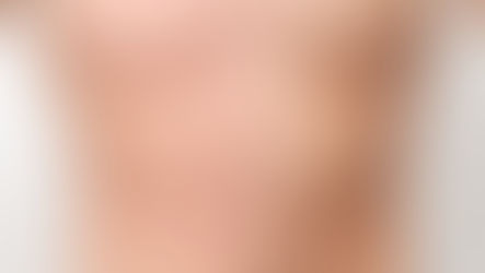 男性胸毛的迷思？