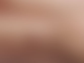 《 疣、血痣、油脂粒、肉粒從何而來?一槍氣化,還你光滑皮膚》