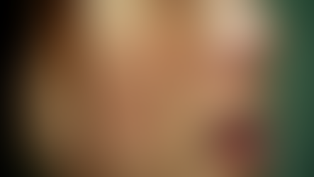 《斑點風暴：當你的臉成了時光的地圖，如何逆轉這場色素入侵？》