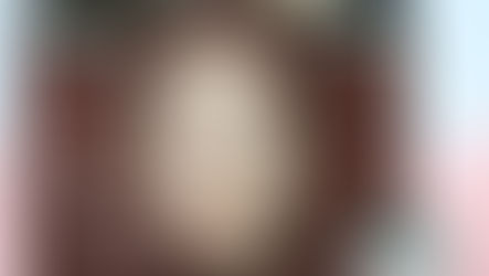 「臉部抗衰」正確思路：了解臉部老化特徵同外源同內源原因，實踐日常護理對抗老化！還原少女肌必試療程！