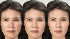 拒絕疲憊感:ALLTIMO 黑金鈦提升療程,打造不需濾鏡的立體緊緻感