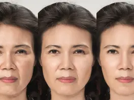 拒絕疲憊感:ALLTIMO 黑金鈦提升療程,打造不需濾鏡的立體緊緻感