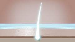 追求極致絲滑:為什麼 GentleLase Pro 755nm 是雷射脫毛的黃金標準?