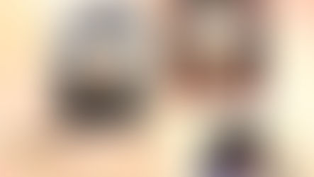 哪些人最適合做HIFU療程？有哪些禁忌人群？ ＼HIFU GOLD 新一代緊膚索／擁有最齊全探頭！更能針對不同需求進行精準調理。