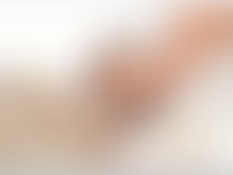 Micose de unha: o que é, como tratar, dá para prevenir?