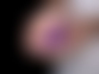 Bendita Saúde: Reumatologista fala sobre o lúpus