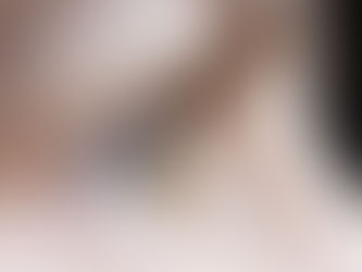 Ceratocone: saiba sobre a doença que atinge os olhos