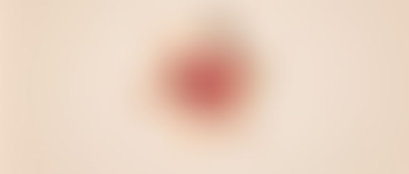 Doar vida: Semana de Mobilização Nacional para Doação de Medula Óssea