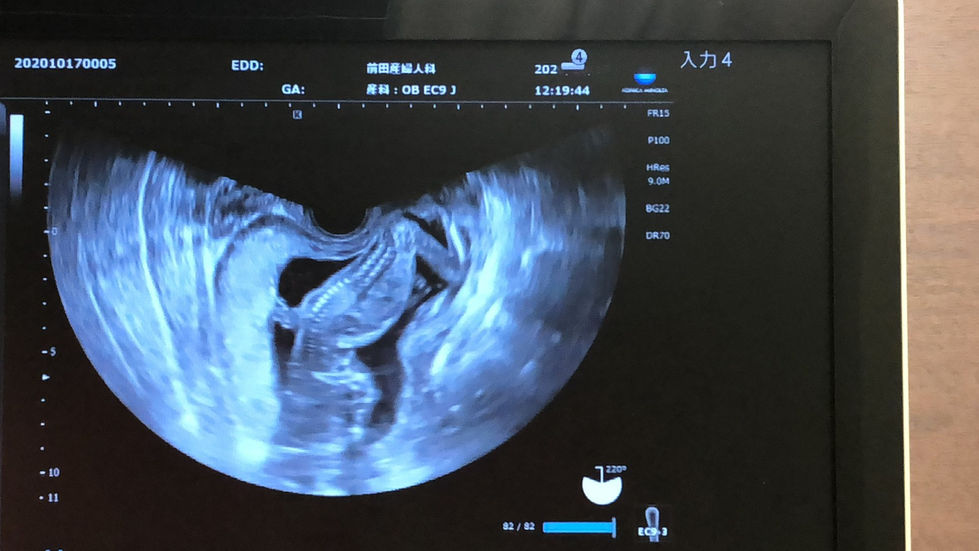 LINE_ALBUM_230412_257