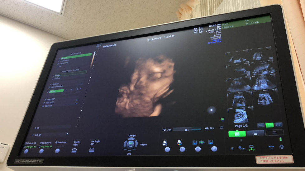 LINE_ALBUM_230412_272