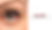 What is Glaucoma?