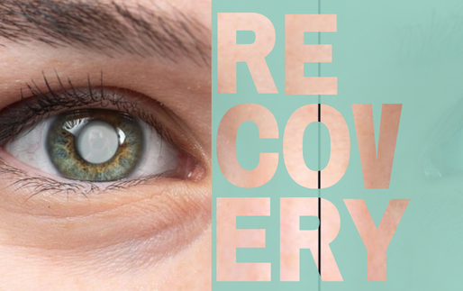 Life After Cataract Surgery: What to Expect after Cataract surgery?