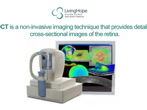 Understanding the Difference Between OCT and Optos