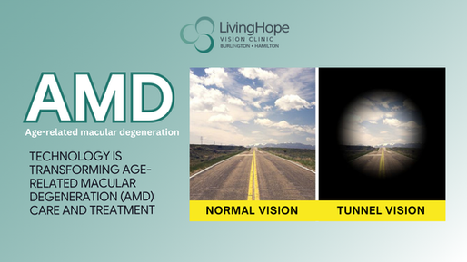 How Technology Is Transforming Age-Related Macular Degeneration (AMD) Care and Treatment