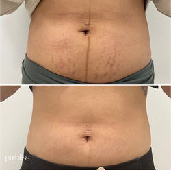 After 2 sessions + 1 IPL