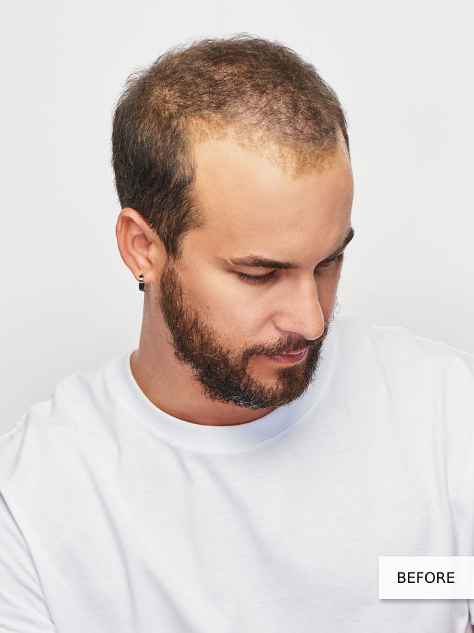Thumbnail: gallant men's wig by him collection before wig