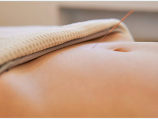 Balancing Hormones Naturally with Acupuncture