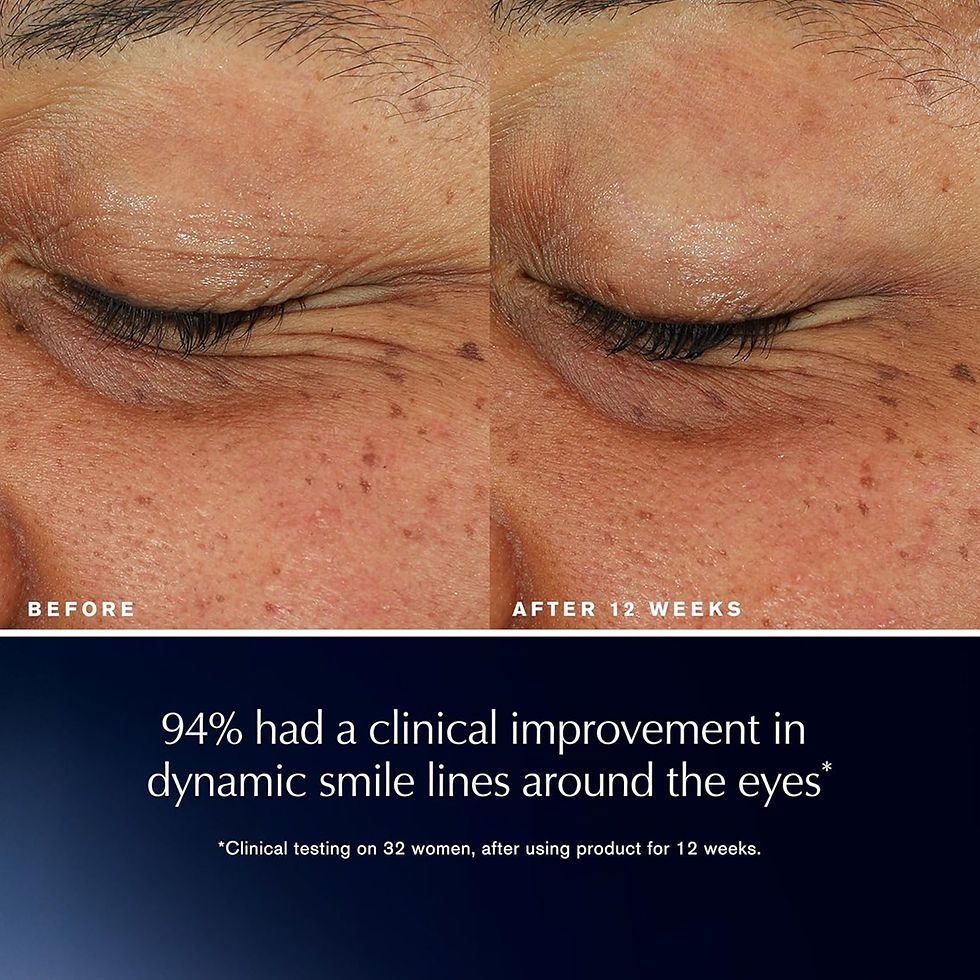 Miniatura: Effetto prima e dopo siero contorno occhi Estée Lauder Advanced Night Repair