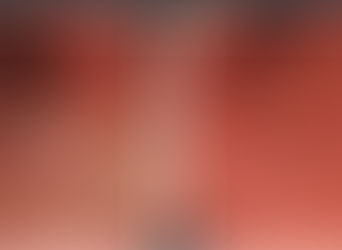 Know Anyone with Ulcerative-Colitis? 