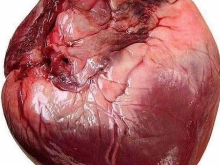 Did You Know That A Heart Attack And Water Go Hand In Hand?