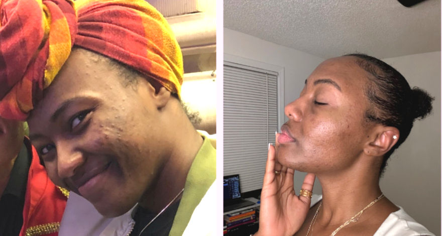 Before and after photo from our loyal client