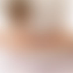 Dickdarmkrebs (kolorektales Karzinom): Früherkennung, Leben, Heilungschancen 