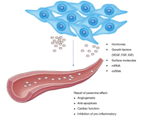 Células madre en infarto de miocardio