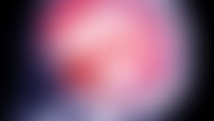 Asundexian en prevención secundaria del ACV