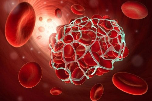 Tromboembolia venosa: no aumenta en covid-19 ambulatorio