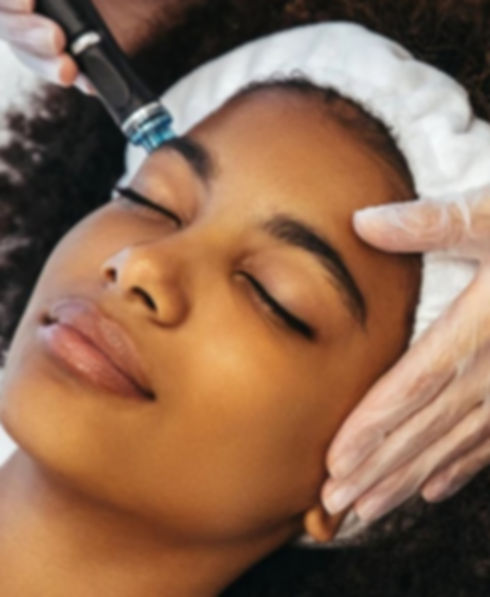 microneedling with SkinPen.jpg