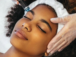 Is Microneedling safe for dark skin?
