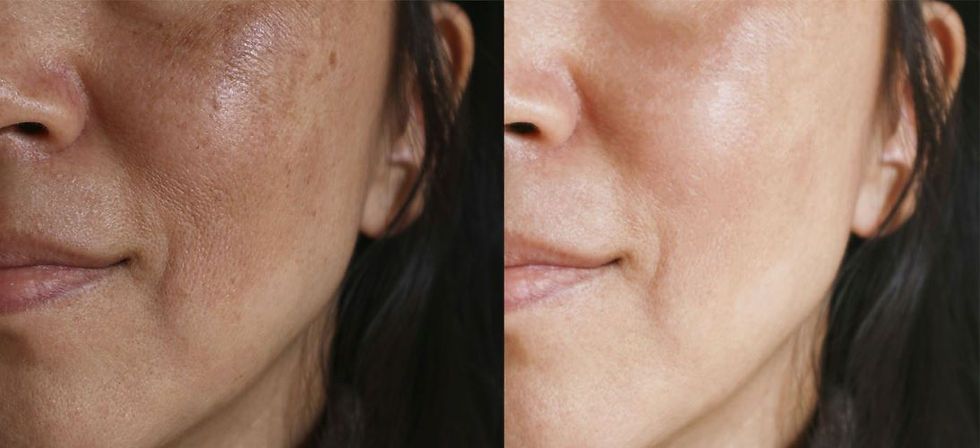 Retinol Before and After photos