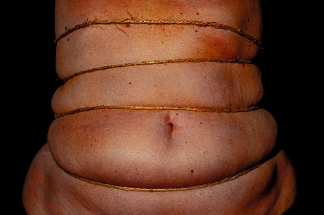 Broken Beauty Series