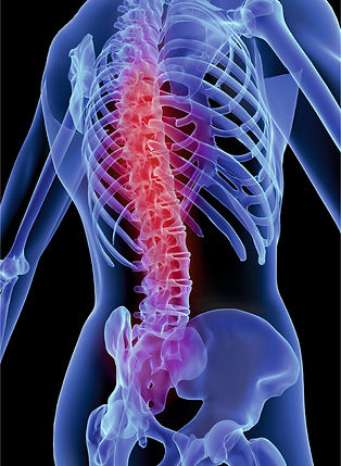 KORE Backpain releaf