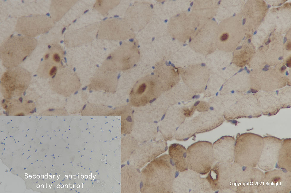 Thumbnail: Anti-FABP3 Antibody, Rabbit Polyclonal