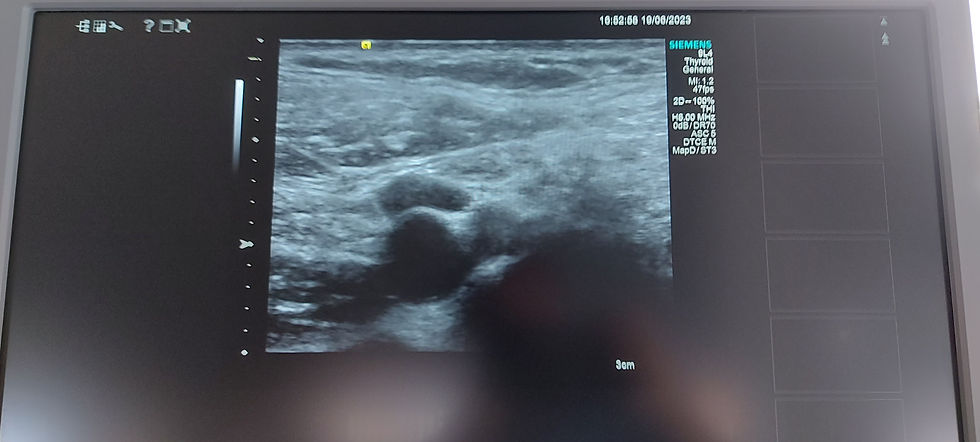 Thumbnail: Siemens ACUSON S1000 Helx TOUCH ultrasound