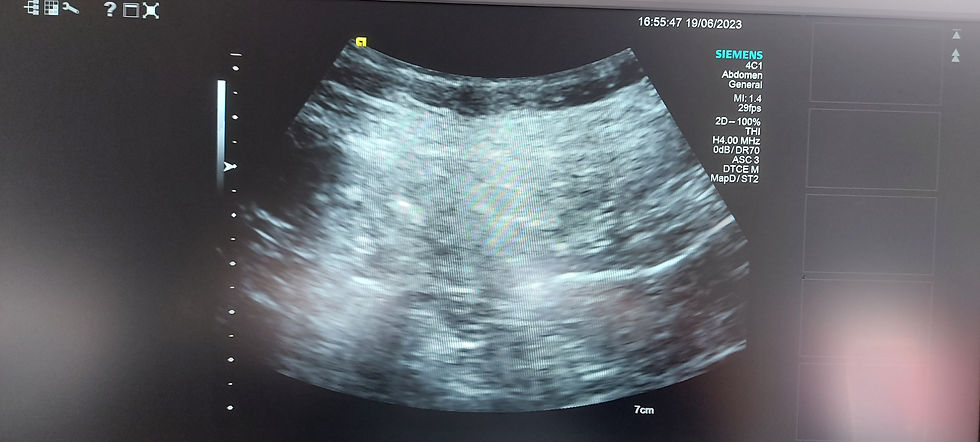 Thumbnail: Siemens ACUSON S1000 Helx TOUCH ultrasound