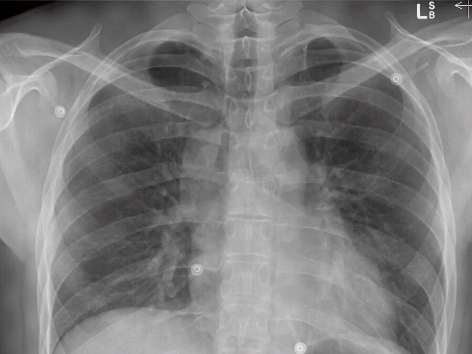 Trauma Forum.gif