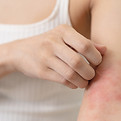 Skin diseases.